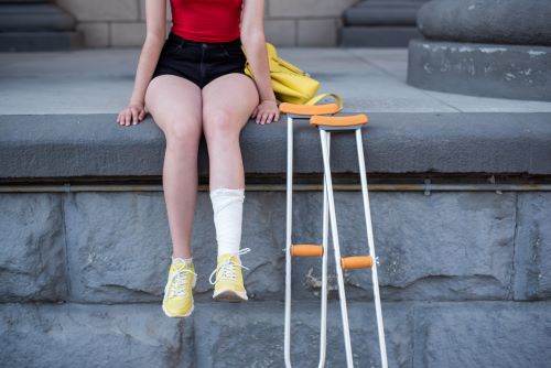An injured woman sits next to the stairs with her crutches.