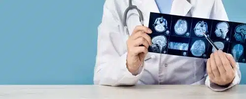 A doctor reviews an MRI for trauma to the brain.