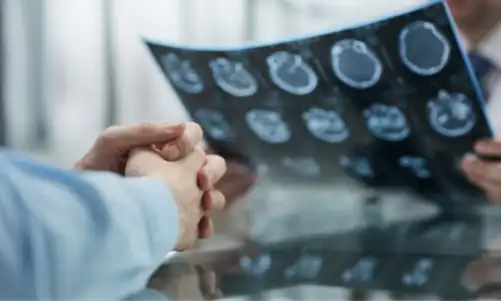 A doctor holding up a brain scan while discussing brain injuries with a patient.