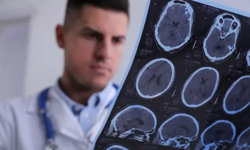 A doctor looking closely at a patient's brain scan in a hospital clinic.