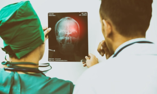 A doctor holding up a brain scan with damage highlighted.