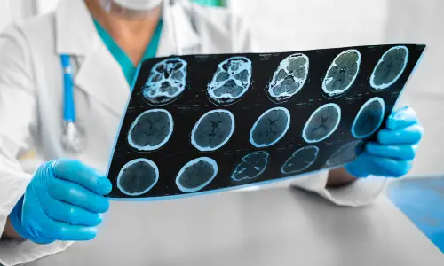 A doctor in a clinic holding a brain scan up in front.