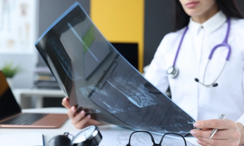 Female doctor examining spinal and brain X-ray images at her desk, symbolizing diagnosis and treatment following a brain injury