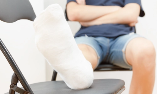 Man with a broken foot as a result of a California construction accident