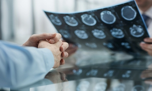 A Nogales brain injury attorney consults with a medical professional while reviewing a detailed brain X-ray.