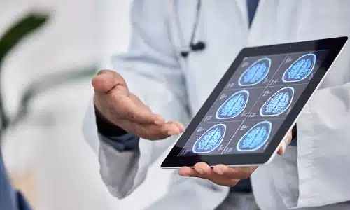 A chest-level shot of a doctor presenting brain scans displayed on a tablet.